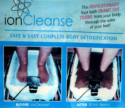 Section of the IonCleanse poster showing “before” and “after” photos.