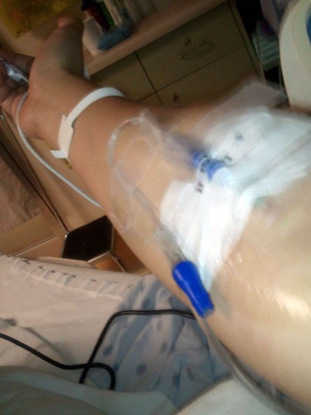 Joey deVilla's arm, with an IV line attached to it