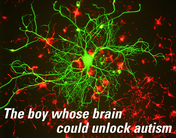 the boy whose brain could unlock autism
